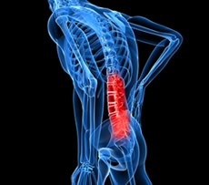Lower Back Pain - treatment